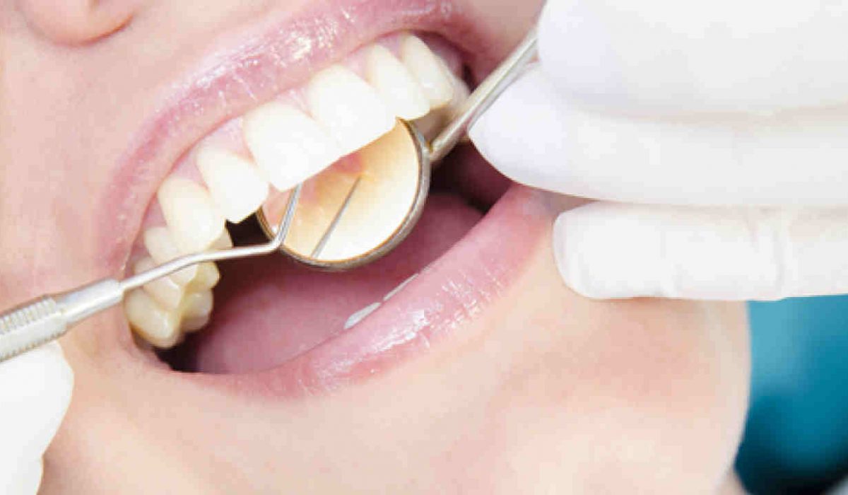 Stomatologia estetyczna Toruń -zabiegi DSD implanty wybielanie zębów